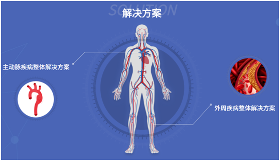 外周血管疾病(外周血管疾病的主要原因之一)